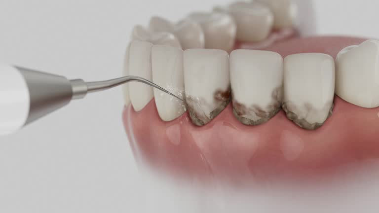 Reliable Teeth Cleaning And Checkup contractor in Cherry Valley, CA by Smile Center Dentistry